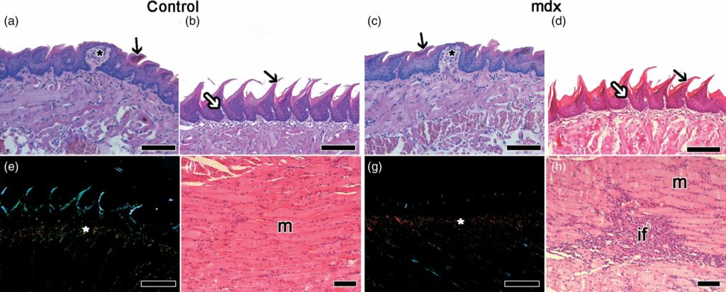 Structural and Ultrastructural Changes in the Tongue of mdx Mice.